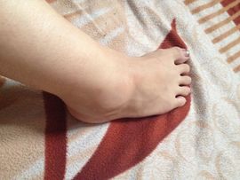 揪痧治咽炎主播照片