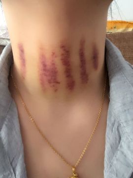 天甜唱歌给你听主播照片