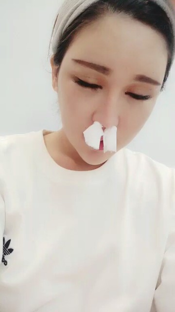 假象牙