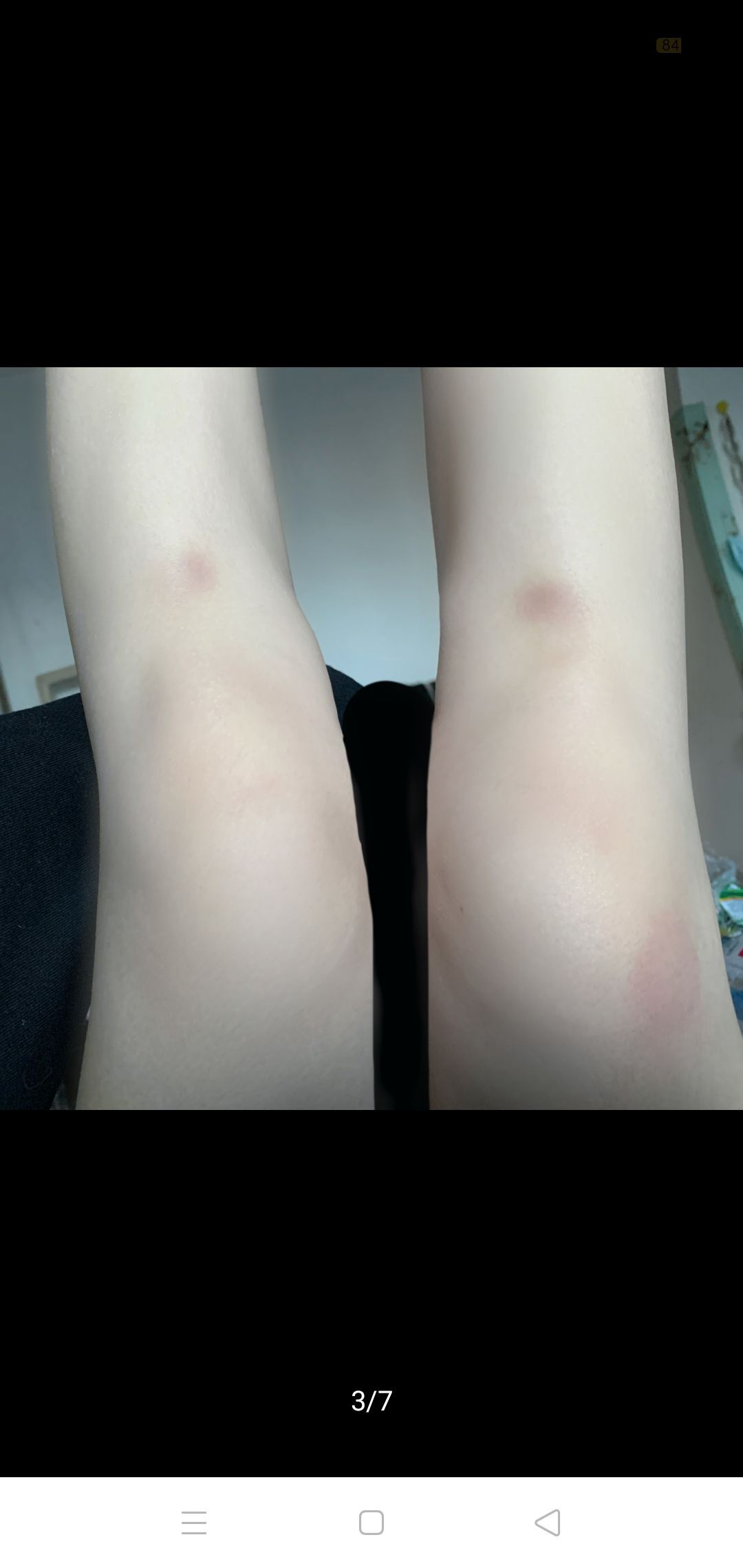 我若迷路煕酒是我的眼的主播照片