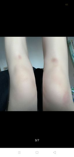 我若迷路煕酒是我的眼主播照片