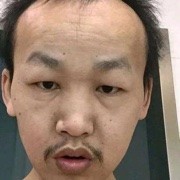 瘦乎乎