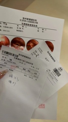 大拉馨💌差2个火山主播照片