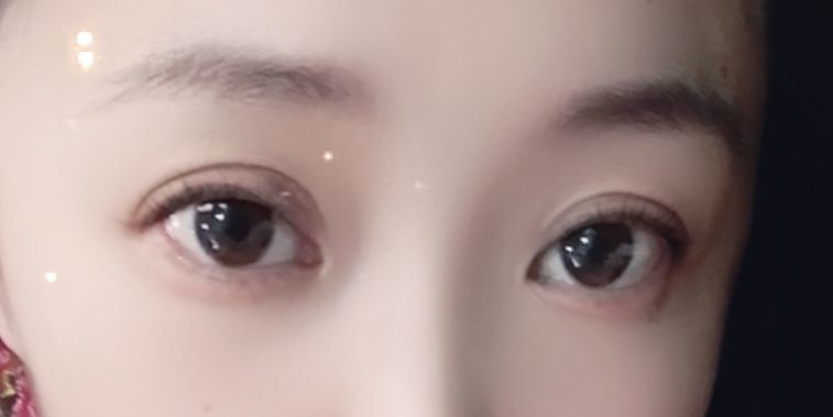 丑小鸭💞愿有一束光的图片