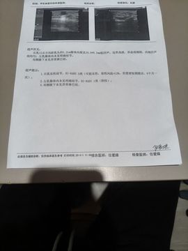 ☞雪儿♞930☜主播照片