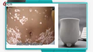 江苏白癜风医院怎么样