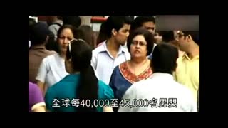 先天畸形 印度男婴天生两个头