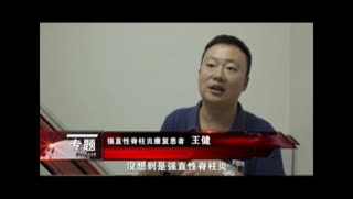成都最好强直性脊柱炎医院