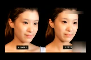完美妆容 上海埋线针灸减肥价格.WMV