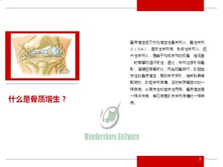 骨质增生能根治吗