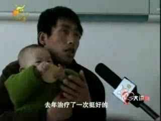 郑州治疗鲜红斑痣最好的医院郑州长峰医院