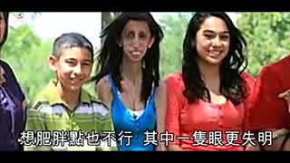 “世界最丑女人”拍纪录片 向欺凌说不