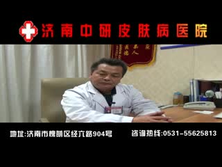 头顶脱发去哪家医院济南 --济南中研