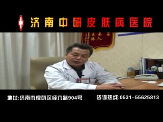 济南中研皮肤病医院谁看脱发最好