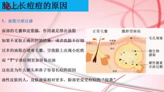 朵嘉浓实体店：脸颊-额头-鼻子痘痘又痛又痒！想要祛痘，首先要知道长痘痘的原因