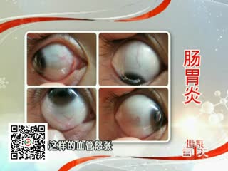 2014健康每一天31_瑶医覃迅云全面分析腹泻并给出治疗建议
